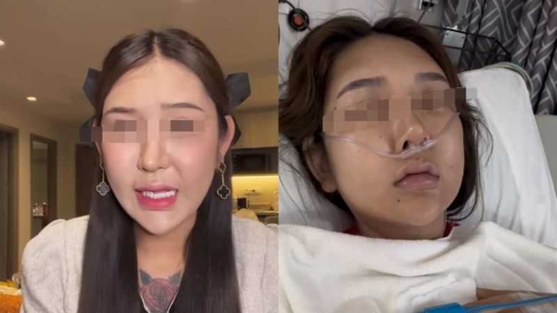 注射丰胸一般多少钱