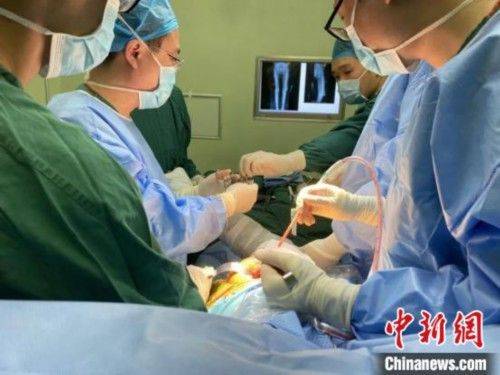 髋关节置换术多少钱