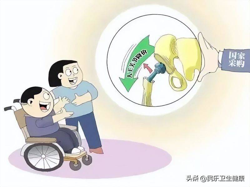 髋关节置换术多少钱