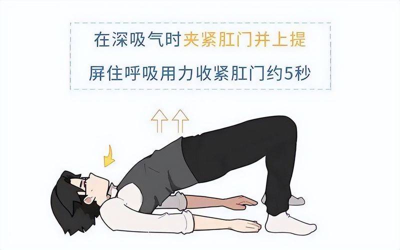 The method of exercise for treating hemorrhoids