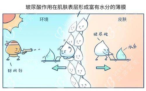 国产玻尿酸多少钱一支