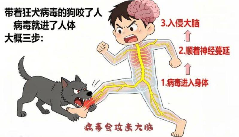 土狗咬伤俩姐弟,11岁姐姐怕被骂隐瞒,几个月后狂犬病发离世,弟弟及时告知家长打疫苗后获救