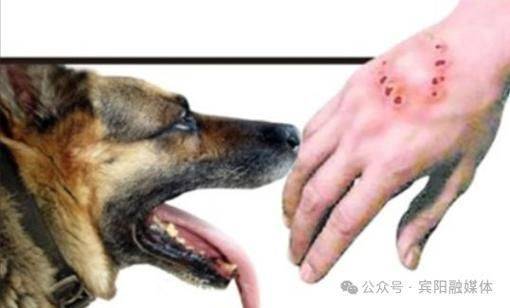 一支狂犬疫苗多少钱