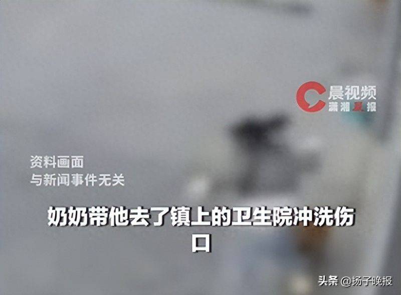 一支狂犬疫苗多少钱
