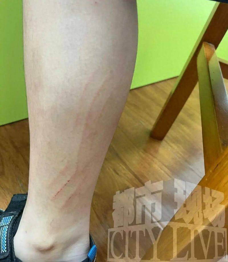 一支狂犬疫苗多少钱