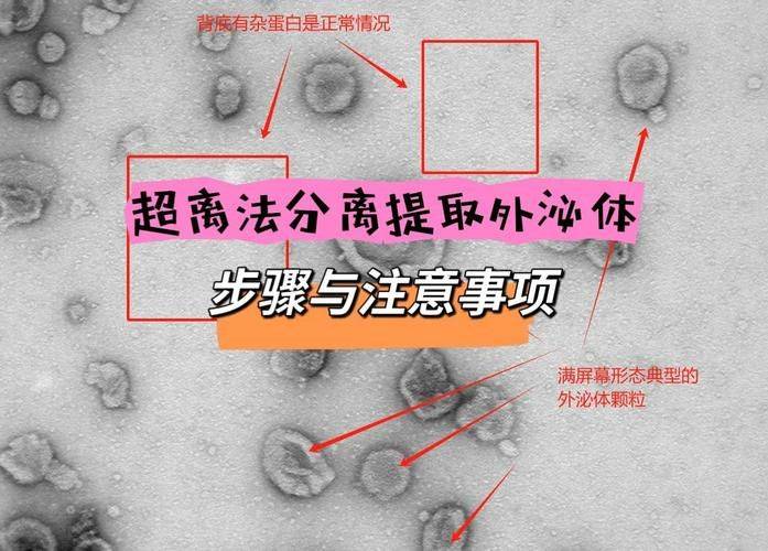 实验室离心机工作原理