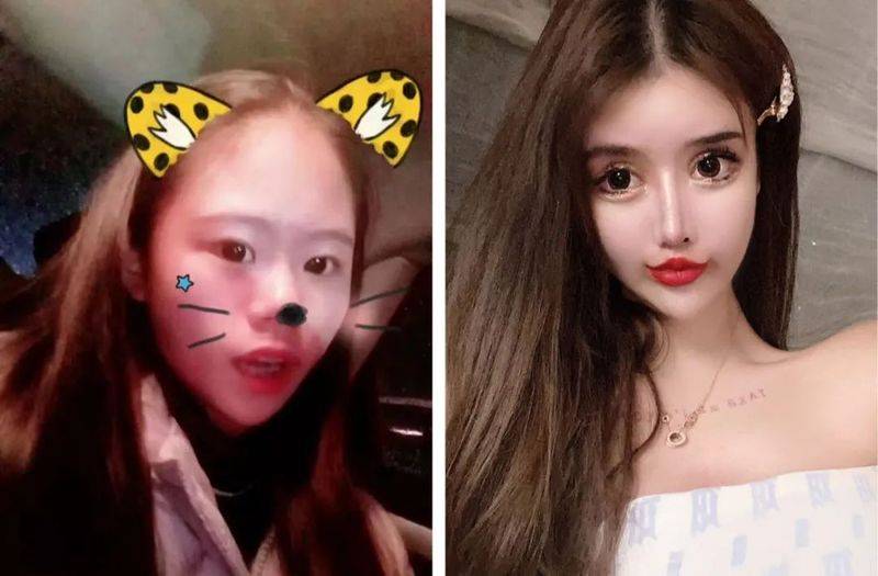 在整容多少钱