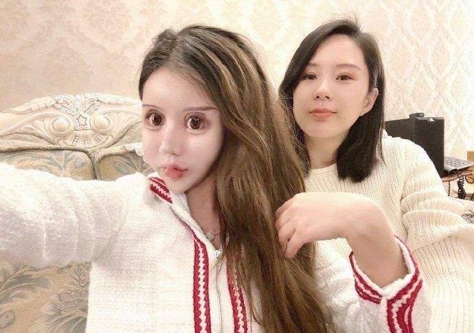 在整容多少钱