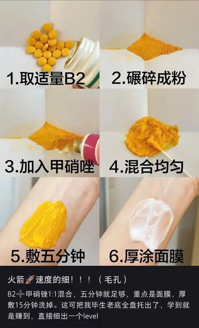脸部痤疮治疗多少钱