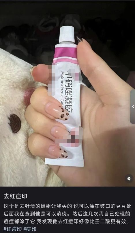脸部痤疮治疗多少钱