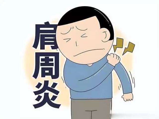 肩周炎的治疗方法