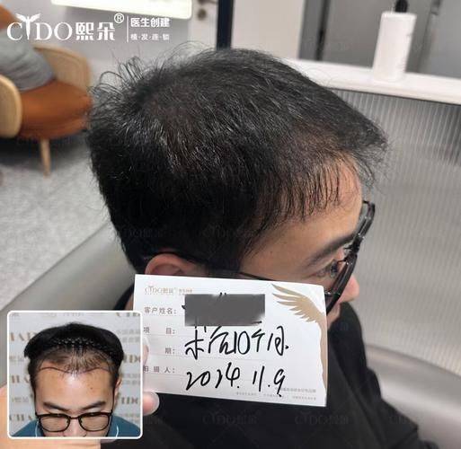 Eyebrow cultivation methods