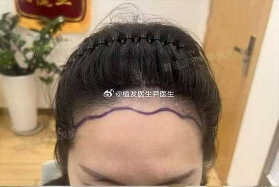 Eyebrow cultivation methods