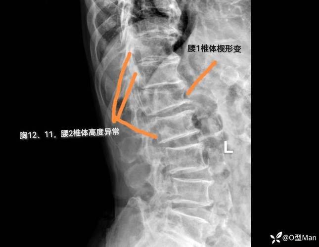 楔形夹具工作原理