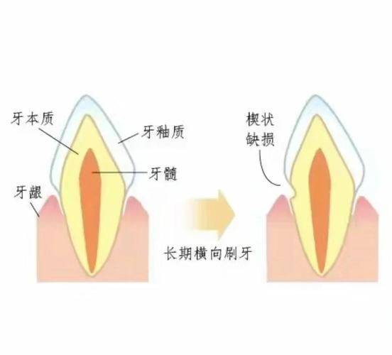 楔形夹具工作原理