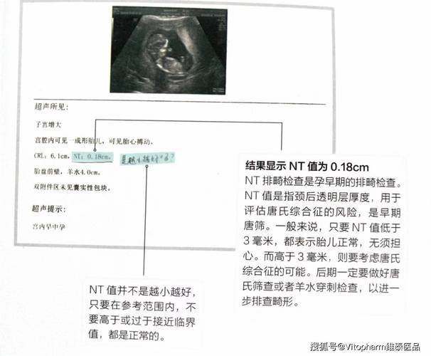大排畸检查多少钱