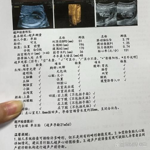 大排畸检查多少钱