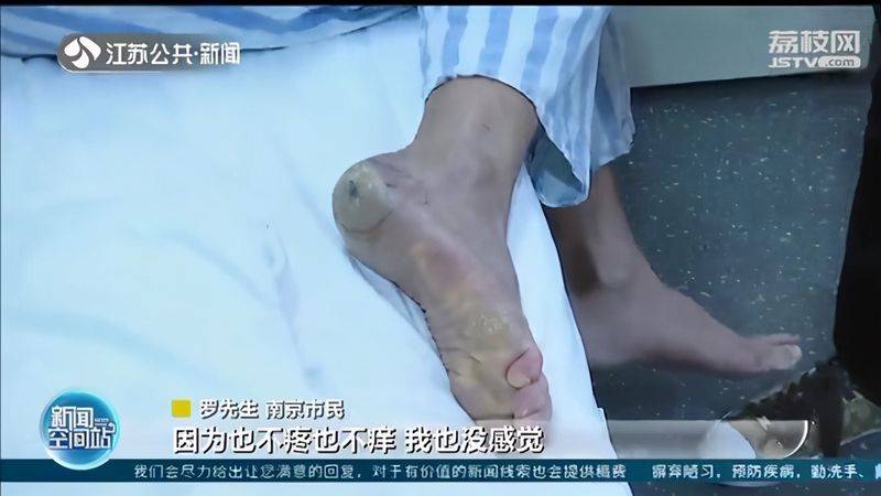 南京鼓楼医院激光去痣多少钱