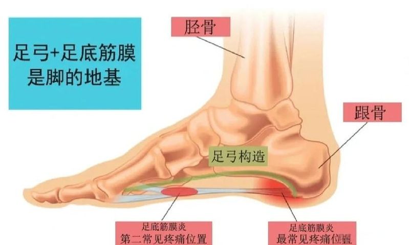足跟骨刺的治疗方法