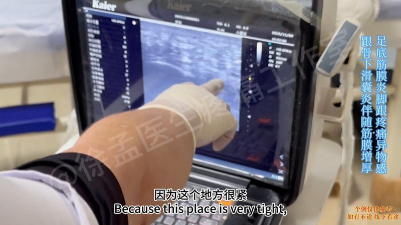足跟骨刺的治疗方法
