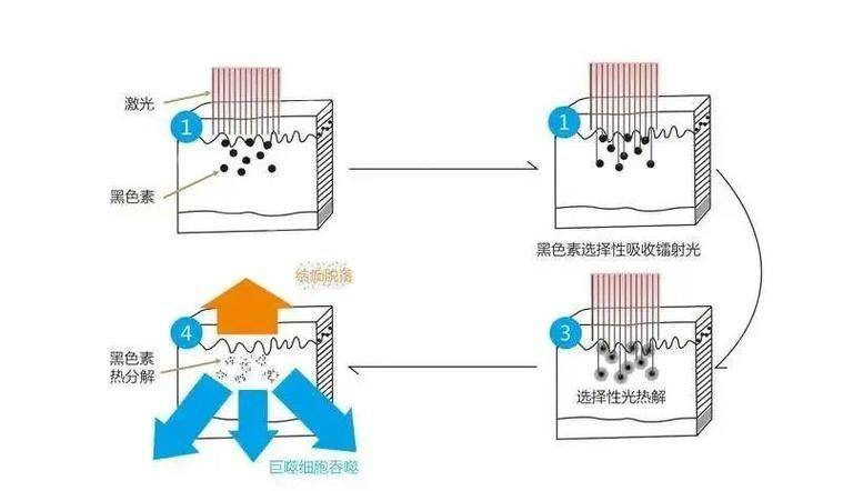 黄褐斑的治疗方法