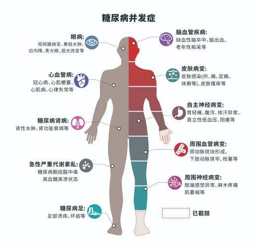 糖尿病知识教育