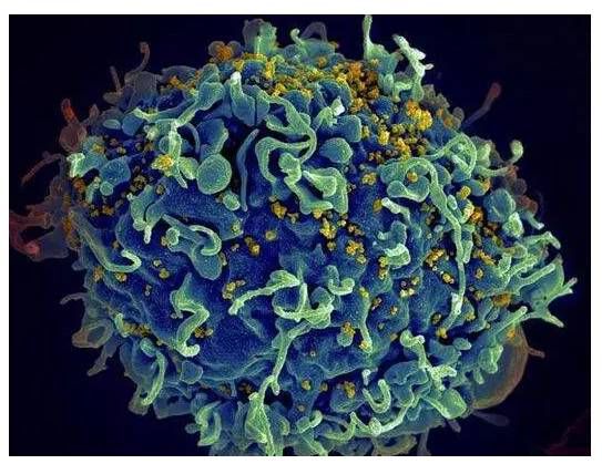 Cart-cell therapy