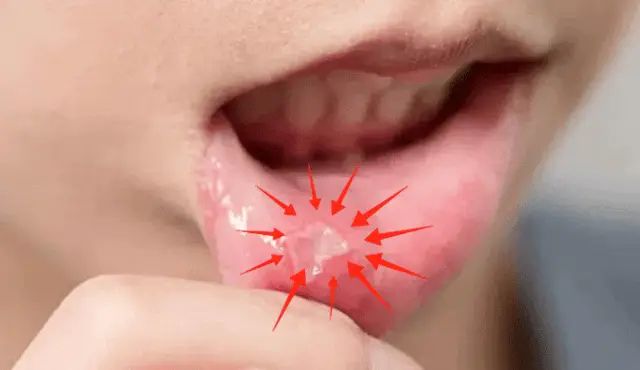 西瓜霜牙膏多少钱