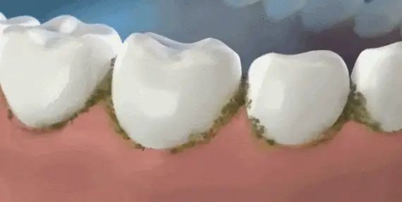西瓜霜牙膏多少钱
