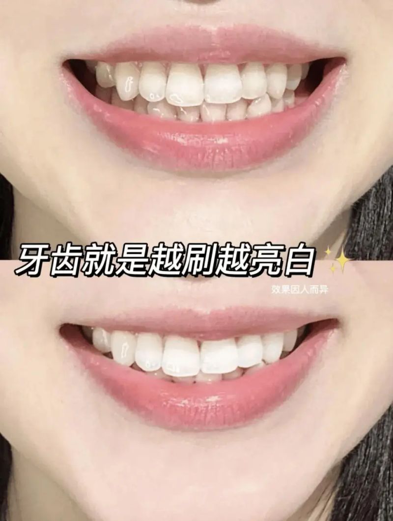 西瓜霜牙膏多少钱