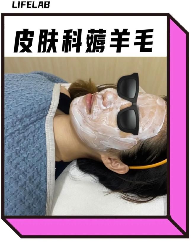 脸部光子嫩肤多少钱