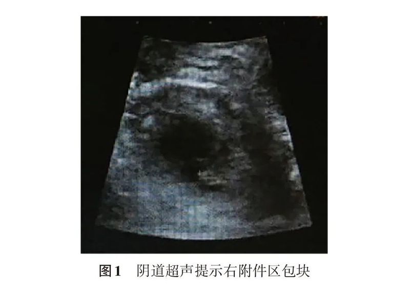 人工授精术费用