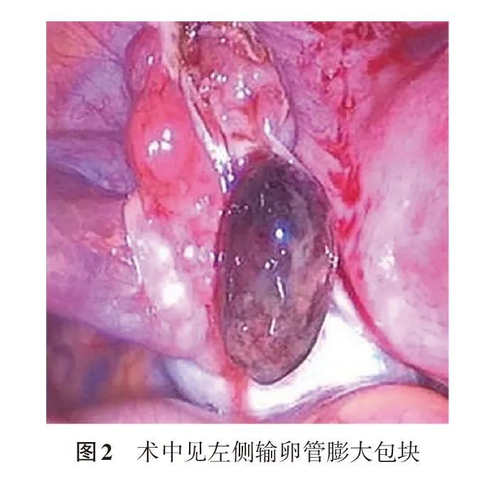 人工授精术费用