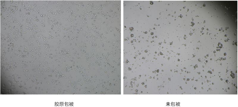 胶原蛋白注射隆鼻多少钱
