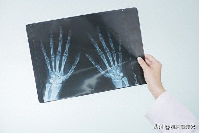 广州测骨龄多少钱