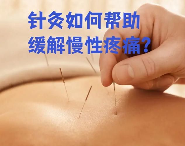 颈肩腰腿痛奇效良方多少钱