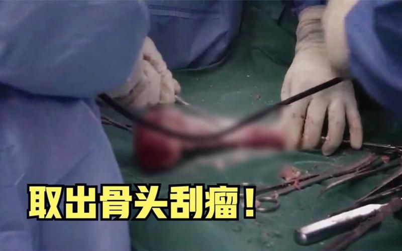 Treatment for bone cancer