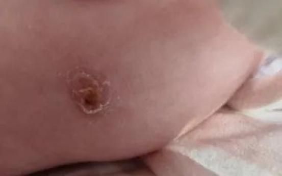 预防接种知识问答