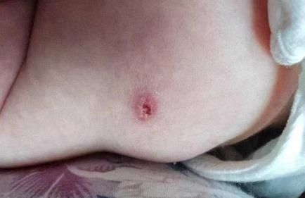 预防接种知识问答