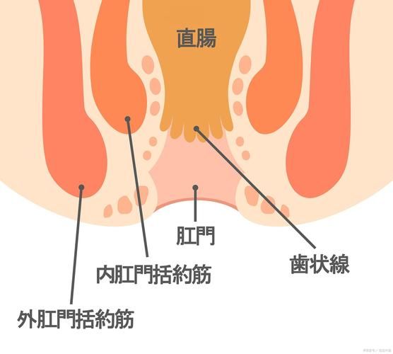 混合痔疮手术多少钱