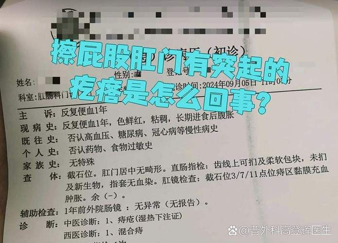 混合痔疮手术多少钱