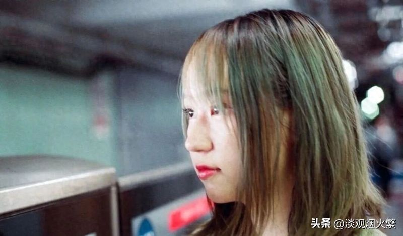整容380次？周楚娜刚做完全脸吸脂，眼睛闭不上！