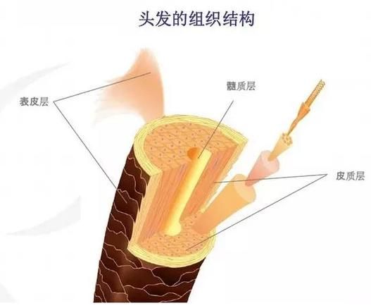 头发移植大约需要多少钱
