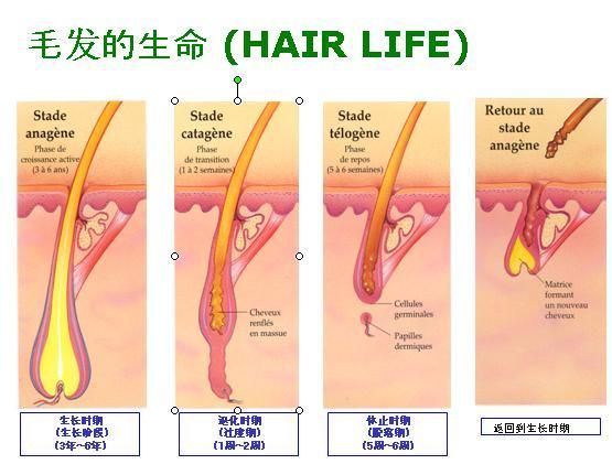 头发移植大约需要多少钱
