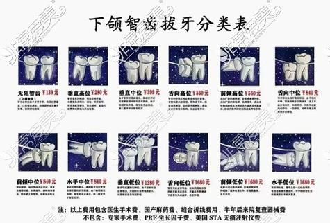 拔牙龈里面的智齿多少钱