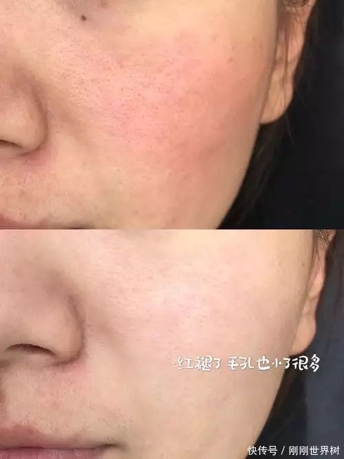 面部清洁步骤