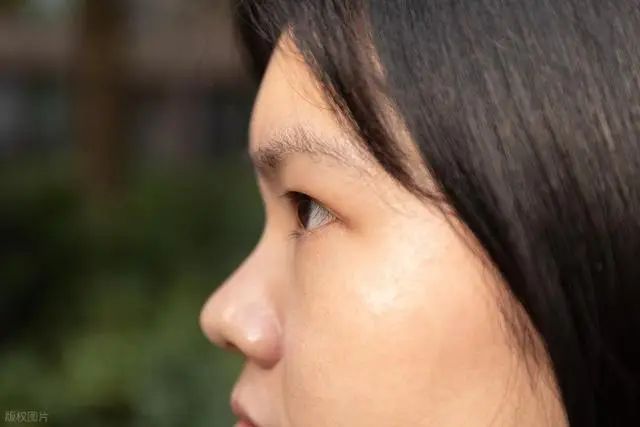 鼻翼肥大下垂费用
