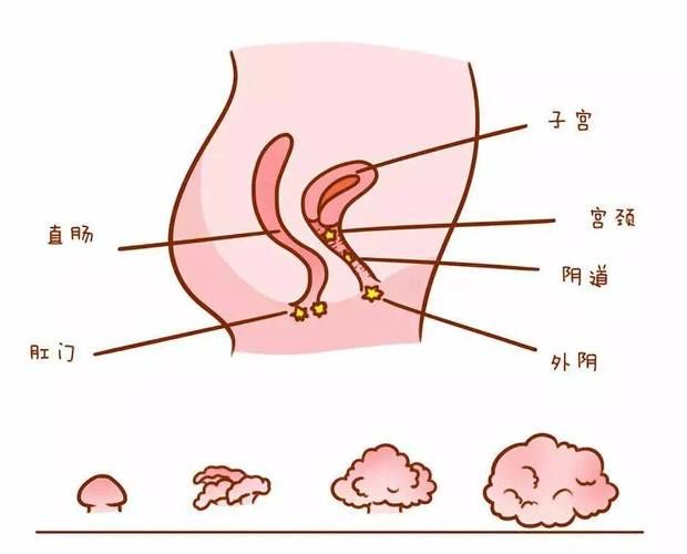 尖锐湿疣怎么治和费用山西