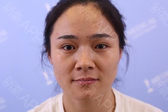 面部清洁步骤