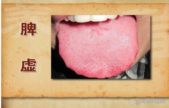 脾胃病知识问答